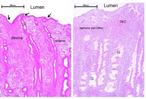 Uterine Weight And Histology Of Uterine Gland Endomet Vrogue Co