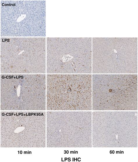 G Csf Induced Lbp Expression Enhanced Lps Binding To The Liver Lps Ich