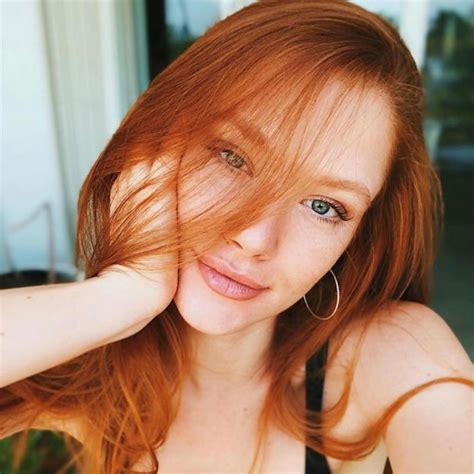10 Amazing Reasons Why Redheads Are So Special