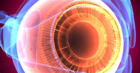 The State Of The Art Of Glaucoma Genetics Ophthalmology Innovation Source