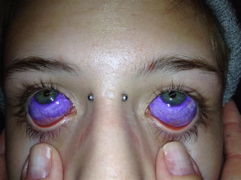 The ink is never injected directly to the sclera tissue but rather between two layers of your eye, which spreads over a large portion of the iris. Eyeball Tattoo: Beware of the New Trend from USA - Micro ...