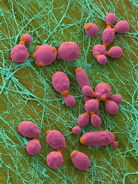 Candida Infected Medical Catheter Photograph By Dennis Kunkel