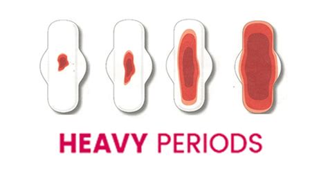 Mygyno Kenya Heavy Periods Heavy Menstrual Bleeding Reproductive