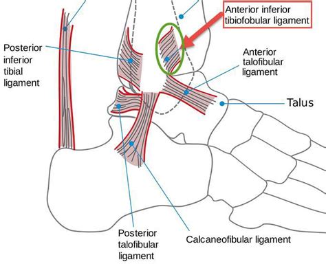 Anterior Tibiofibular Ligament Injury And Treatment New Health Advisor