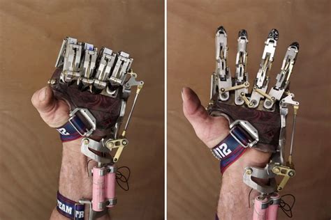 Engineer Designed And Built His Own Functioning Mechanical Prosthetic