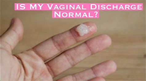 Vaginal Discharge Normal Vs Not Normal