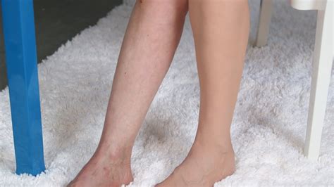 How To Cover Up Spider Veins In 30 Seconds Youtube
