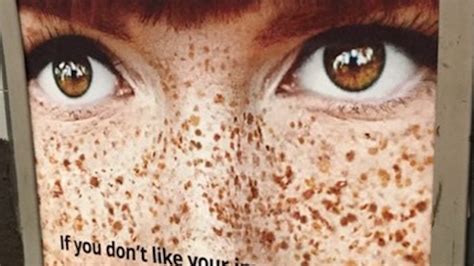 This Ad Called Freckles Imperfections And People Are Furious