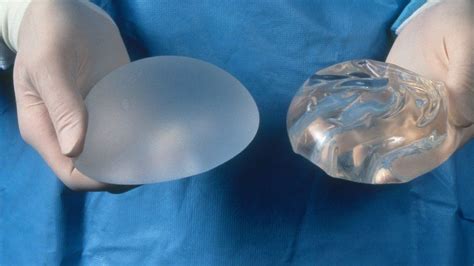 Breast Implant Register Launches To Safeguard Patients Bbc News