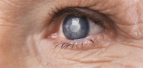 Seeing The Signs Early Detection Of Macular Degeneration For Better