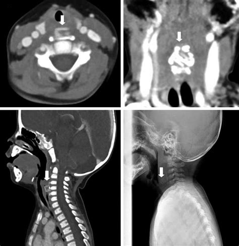 Neck Computed Tomography Ct Scan That Was Carried Out At Hospital Day