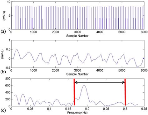 Figure From Real Time Obstructive Sleep Apnea Detection Based On Ecg