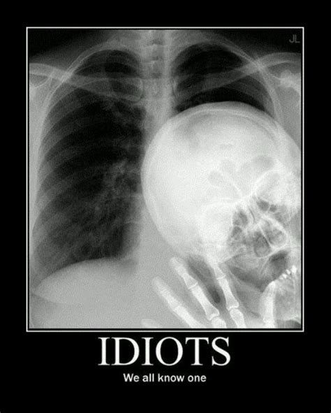 64 Best Radiology Humor Images On Pinterest Medical Humor Radiology