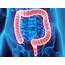 Could Gut Bacteria Drive Colon Cancer