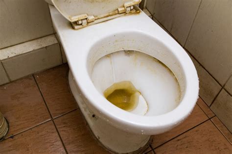 Mérges kétkomponensű Vezetőképesség how to remove stains from toilet bowl homok Rosszul senki