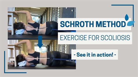 Schroth Method Demo Side Lying Scoliosis Treatment Exercise Youtube