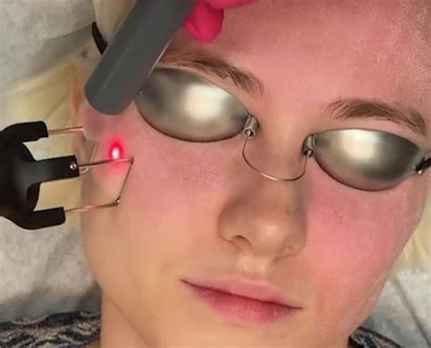 Laser Treatments Qazi Cosmetic Clinic Orange County CA
