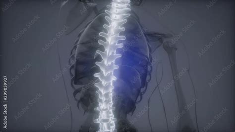 Vidéo Stock Backache In Backbone Science Anatomy Scan Of Human Spine