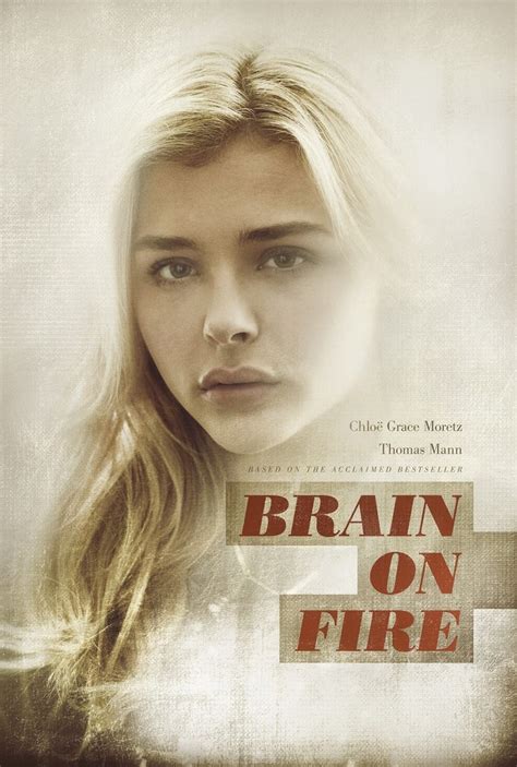 Picture Of Brain On Fire