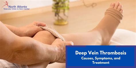 Deep Venous Thrombosis Causes Symptoms Treatment Deep Venous Thrombosis