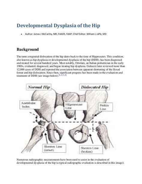 Developmental Dysplasia Of The Hip