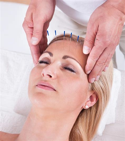All About Facial Rejuvenation Acupuncture The Natural Alternative To