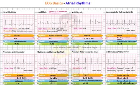 Ecg Basics Atrial Rhythms Cardiology Medstudent Grepmed