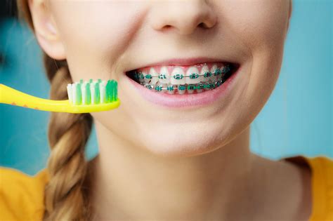Top 7 Oral Hygiene Tips For Those Wearing Braces Erofound