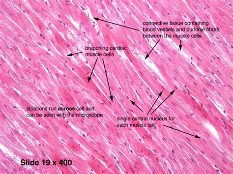 Cardiac Muscle Histology Labelled Diagram My Own Lemon Tree The Best