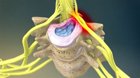 Organs are specialised body parts, each with their own jobs. Organs In Your Lower Back / What S The Link Between Back Pain And Digestion Problems - This ...