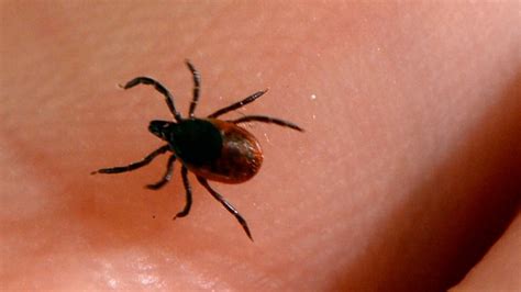 Black Legged Ticks Can Carry The Bacteria That Causes Lyme Disease