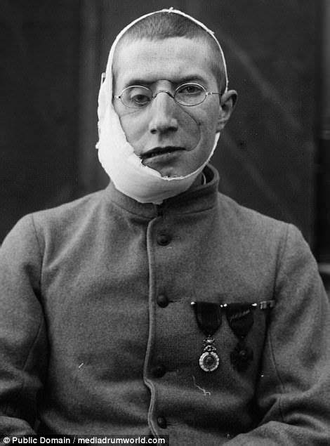 A Man With A Bandage Around His Neck And Glasses On Top Of His Head In