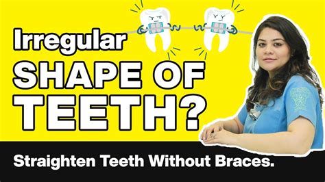 Many people enjoy invisible aligners for the freedom to enjoy special occasions without even worrying about the appearance of braces, but it also means. How to Straighten Teeth Without Braces | Invisalign ...