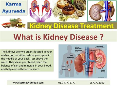 Ppt Kidney Disease Treatment Powerpoint Presentation Free Download