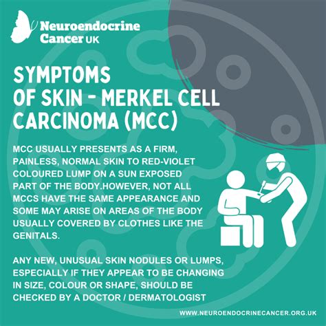 Skin Merkel Cell Carcinoma Symptoms Neuroendocrine Cancer Uk