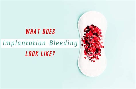 Implantation Bleeding Pad