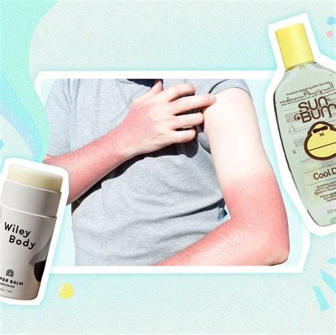 10 Expert Approved Products To Revive Sunburned Skin