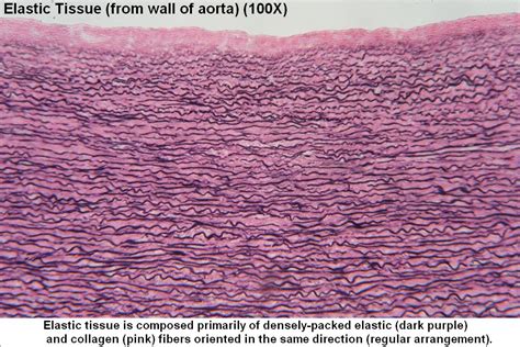 Elastic Tissue Tutorial Histology Atlas For Anatomy And Physiology