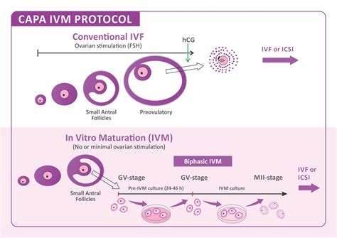 A New Drug Free Ivf Treatment Capa Ivm Infertility Treatment