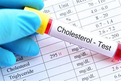 Cholesterol Tests What Exactly Are They Used For 2024