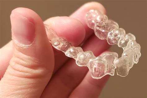 Invisalign Trays Cracking Patient Experiences And What To Do Dental