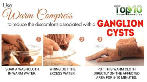 Home Remedies For Ganglion Cysts Top 10 Home Remedies