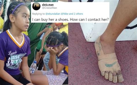 YO Athlete Wins Gold Medals In Shoes Made Of Bandages