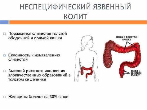Диета и лечение при гепатозе Неспецифический Язвенный Колит Симптомы Лечение Диета — Похудение Диета Неспецифический Язвенный Колит Симптомы Лечение Диета — Похудение Диета Диета и лечение при гепатозе