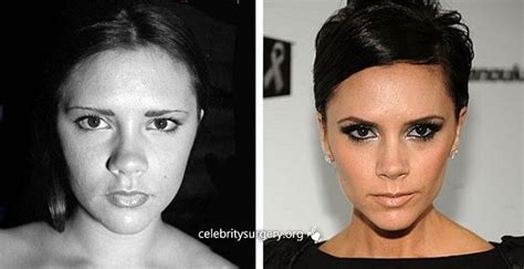 Celebrity Victoria Beckham Before And After Nose Job Beckham Celebrity Job Nose Victoria