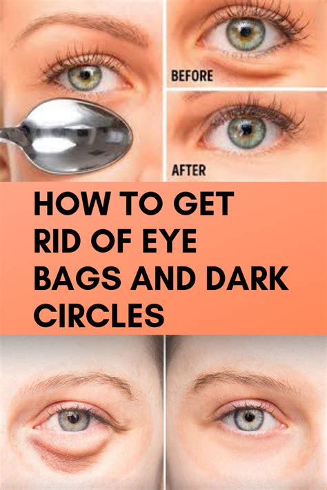 List Of What Is The Cause Of Eye Bags References Beauty Shop