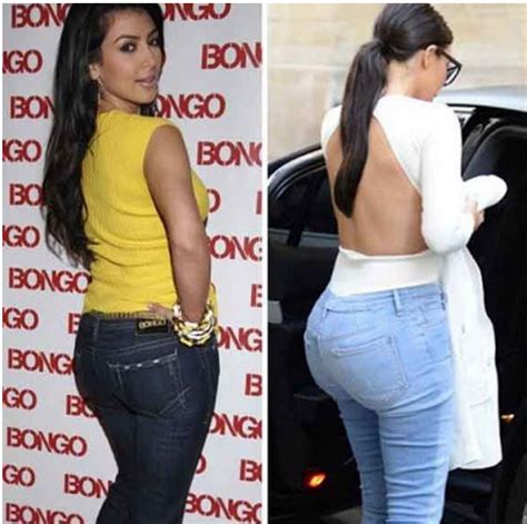 Kim Kardashian antes y después de inyectarse grasa en los glúteos Diario El Mundo