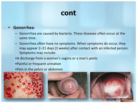 Syphilis is a very dangerous sexually transmitted infection, caused by a bacterium treponema pallidum, which most common symptoms are lesions of the skin, mucous syphilis: Different between syphilis & gonorrhea