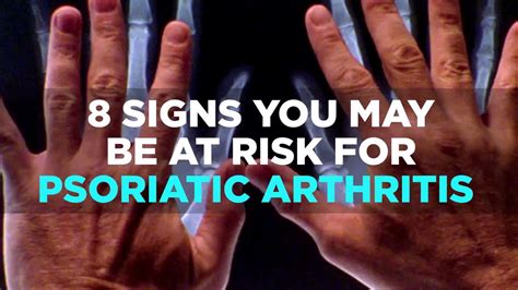 8 Signs You May Be At Risk Of Psoriatic Arthritis Aol Uk Living