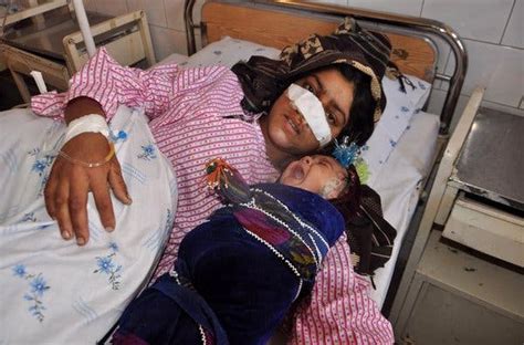 Afghan Womans Nose Is Cut Off By Her Husband Officials Say The New
